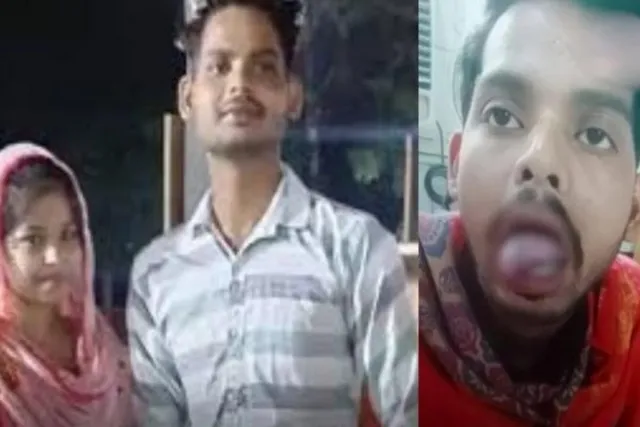 கணவரின் நாக்கை கடித்து துப்பிய மனைவி..!! போலீஸ் விசாரணை..!!