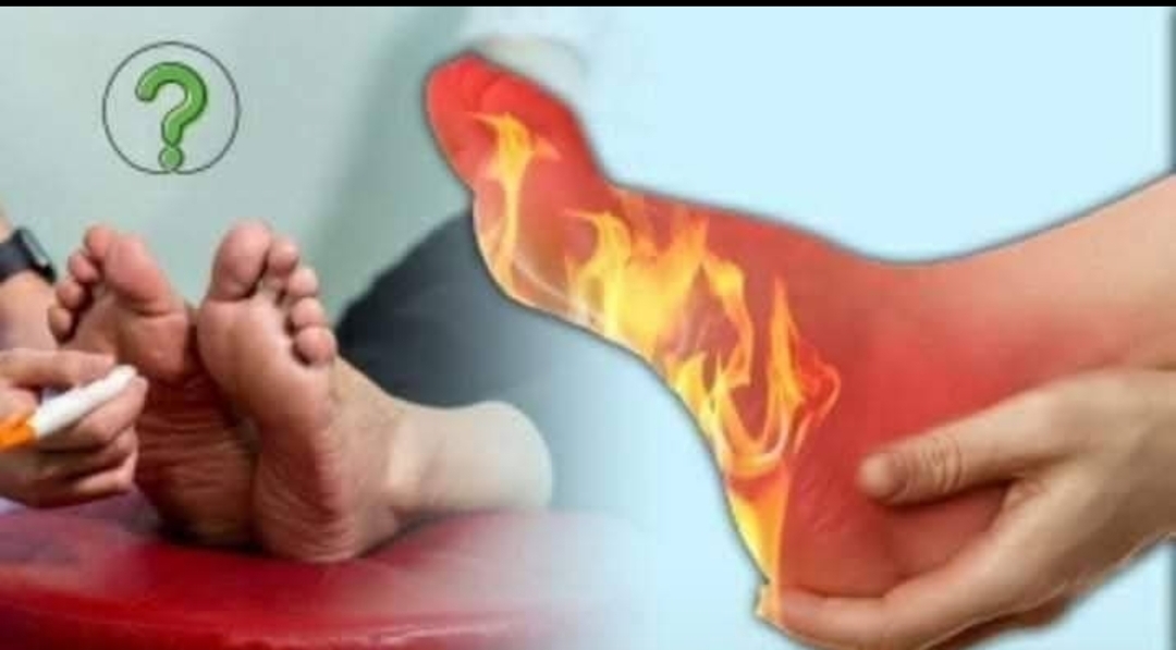 இரவில் கால் ரொம்ப எரியுதா?.. அப்ப இந்த வழிகளை ட்ரை பண்ணிப் பாருங்க..!!