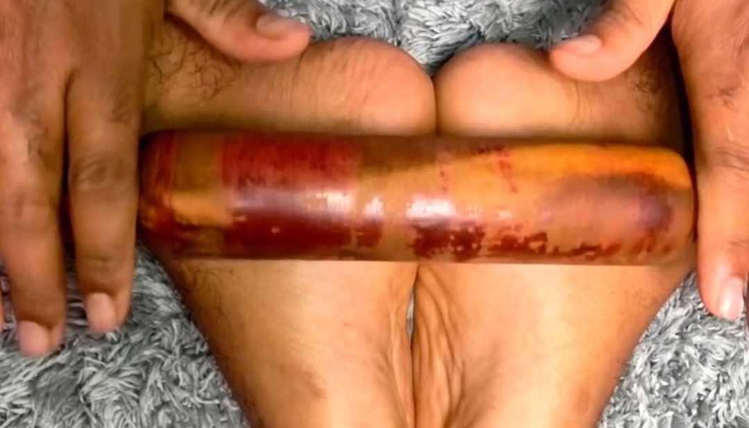 உடல் மற்றும் கால் வலி நீக்கும் அக்குபிரஷர் பயிற்சி..!!