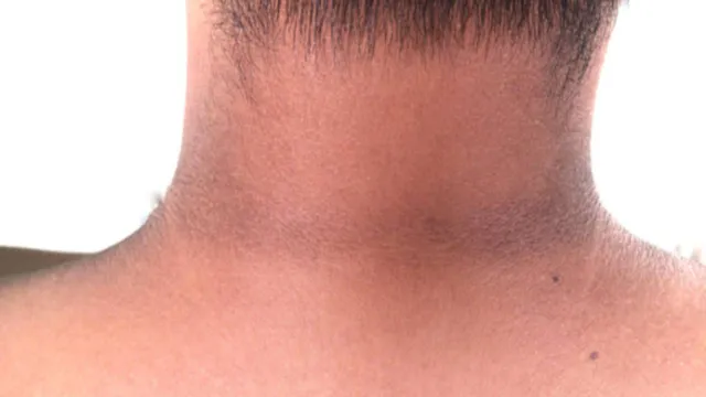 உங்க கழுத்துக்கு கருமையா இருக்கிறதா..?? அதற்கு இத மட்டும் பண்ணுங்க தீர்வு கிடைக்கும்..!!