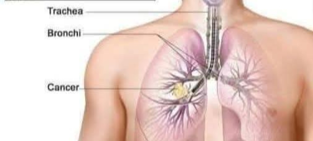 நின்று கொண்டு தண்ணீர் அருந்தக்கூடாது..!! ஏன் தெரியுமா..??