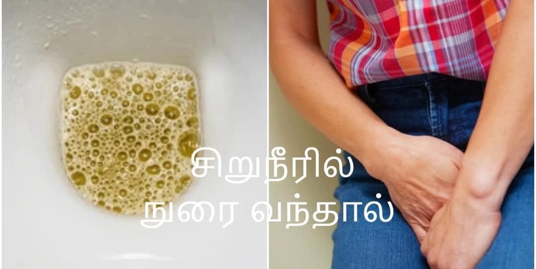சிறுநீரில் நுரை வந்தால் ஆபத்தா..?? கண்டிப்பா அனைவரும் இந்த பதிவை படிங்க..!!