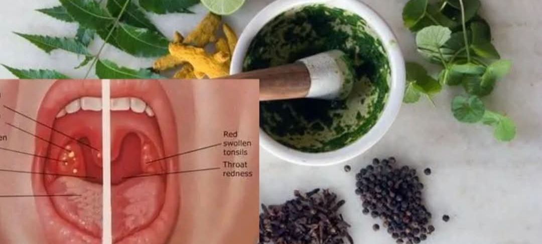 தொண்டை கரகரப்பு, தொண்டை புண் சரியாக.. இயற்கை வைத்தியம்..!!