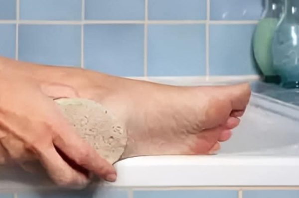 கால்களில் இருக்கும் வெடிப்பிற்கான தீர்வுகள்..!!