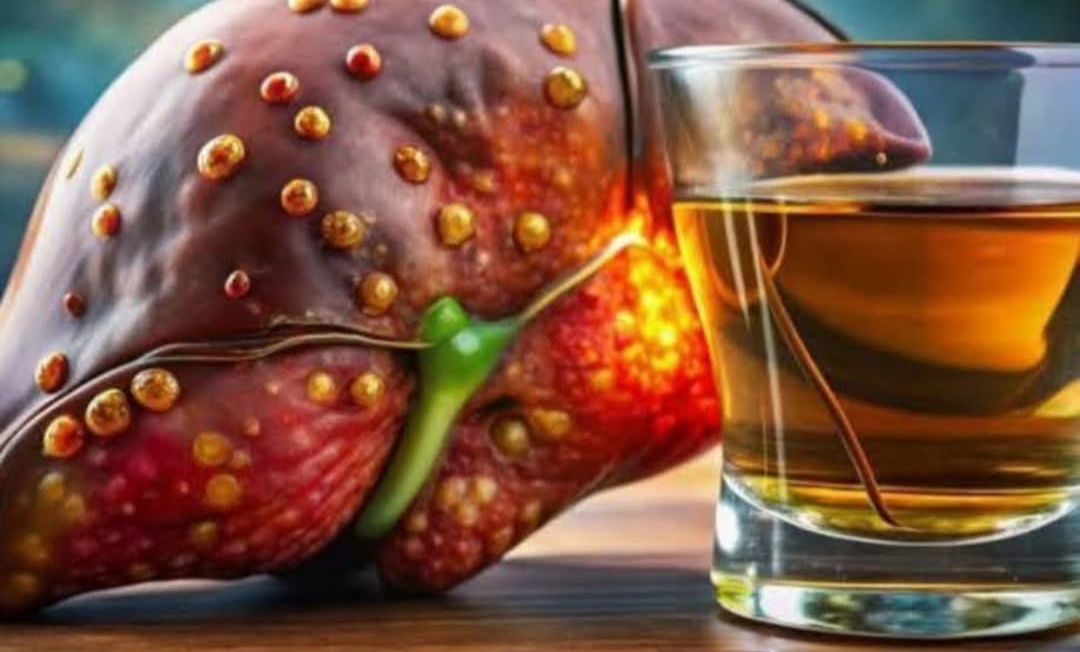 கல்லீரலில் இருந்து கொழுப்பை இயற்கையாகவே குறைக்க நீங்க குடிக்க வேண்டிய ட்ரிங்ஸ் ..!!