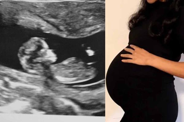 ஆஸ்திரேலியாவில் ஒரே பிரசவத்தில் 4 பெண் குழந்தைகள் பிறப்பு: குடும்பத்தினர் மகிழ்ச்சி..!!